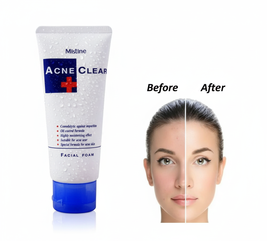 Misline Acne Control Facial Cleansing Foam 85 g