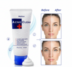Misline Acne Control Facial Cleansing Foam 85 g